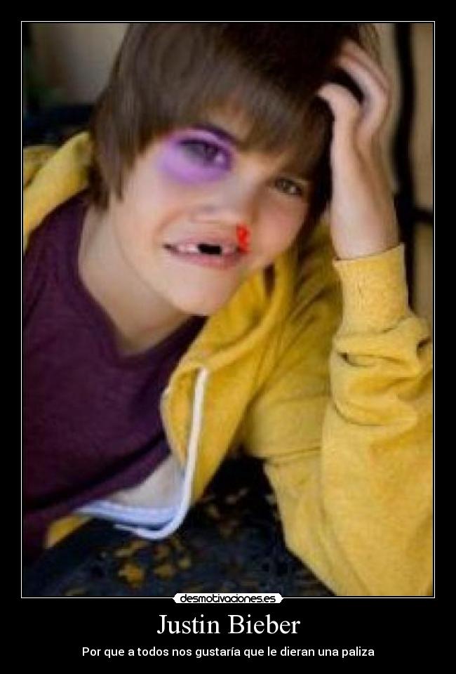 Justin Bieber -