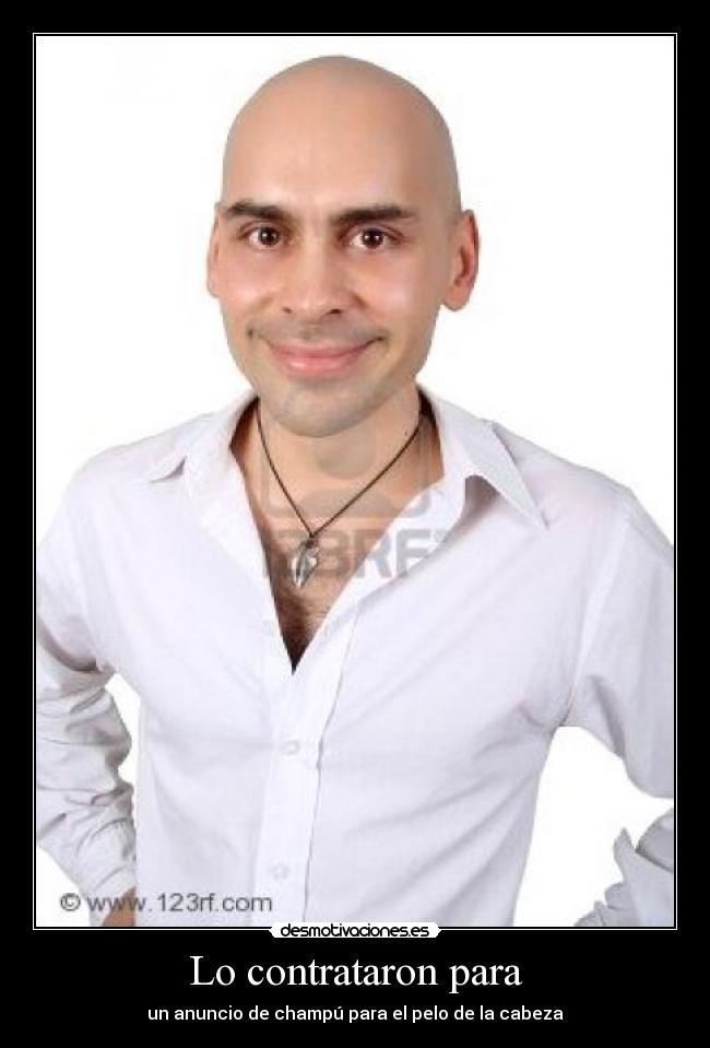 Lo contrataron para - un anuncio de champú para el pelo de la cabeza