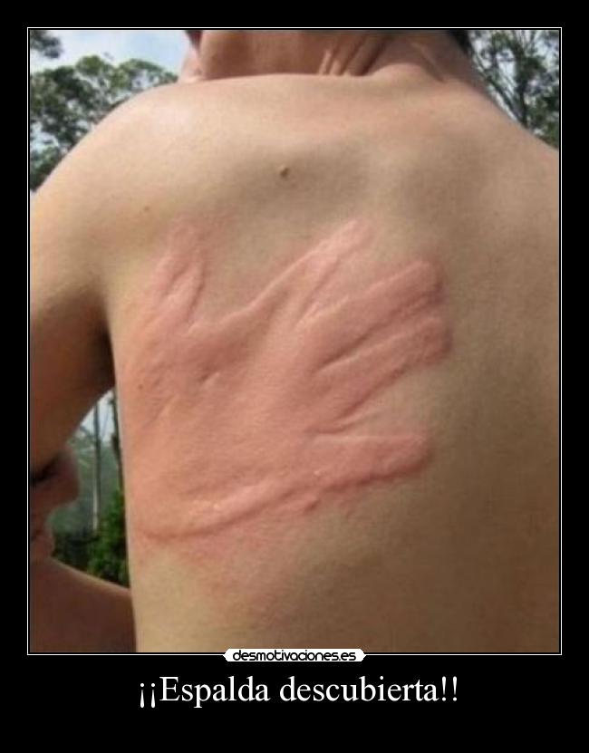 ¡¡Espalda descubierta!! - 