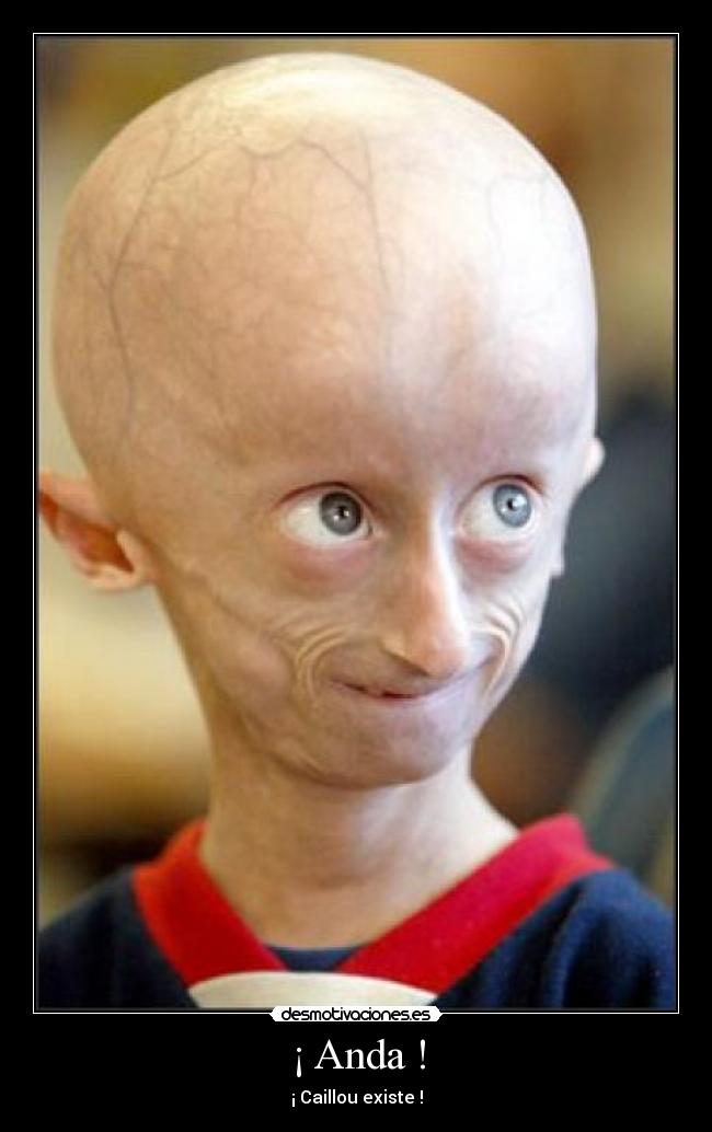 ¡ Anda ! - 
