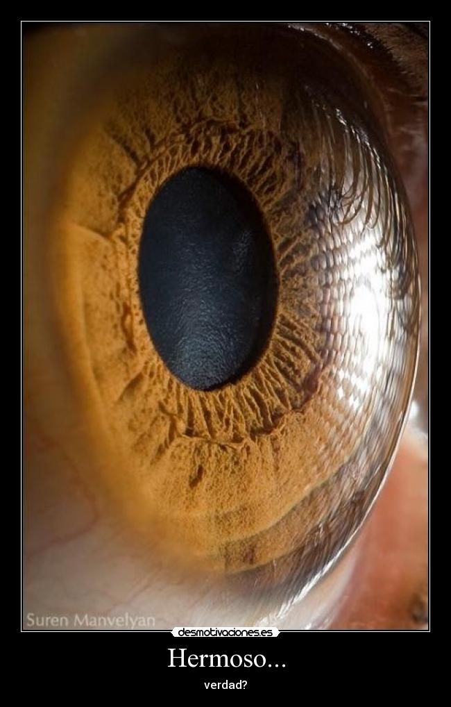 Hermoso... - verdad?