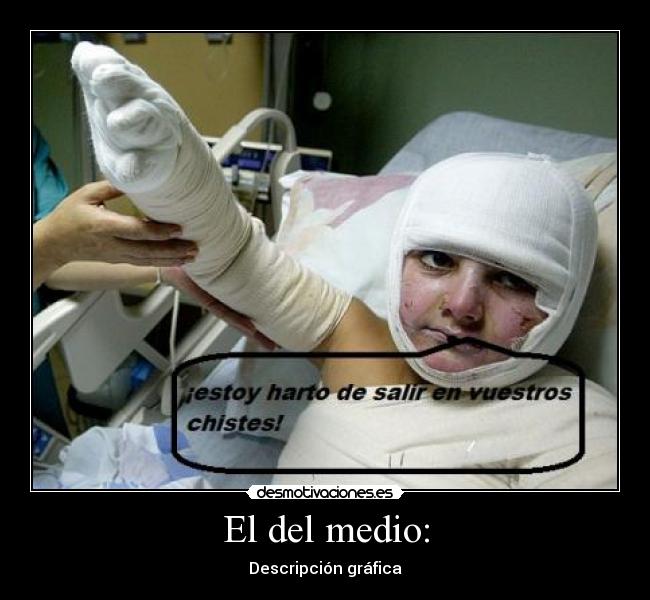 El del medio: - Descripción gráfica