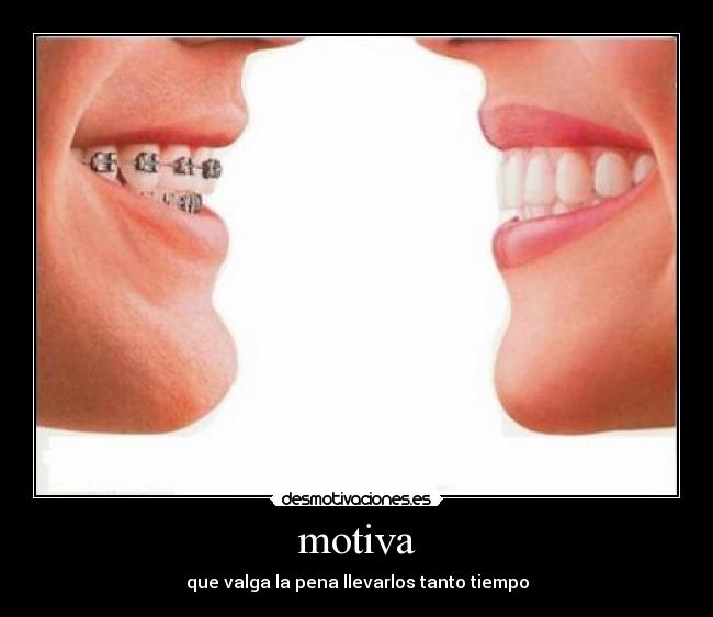 carteles tooth desmotivaciones