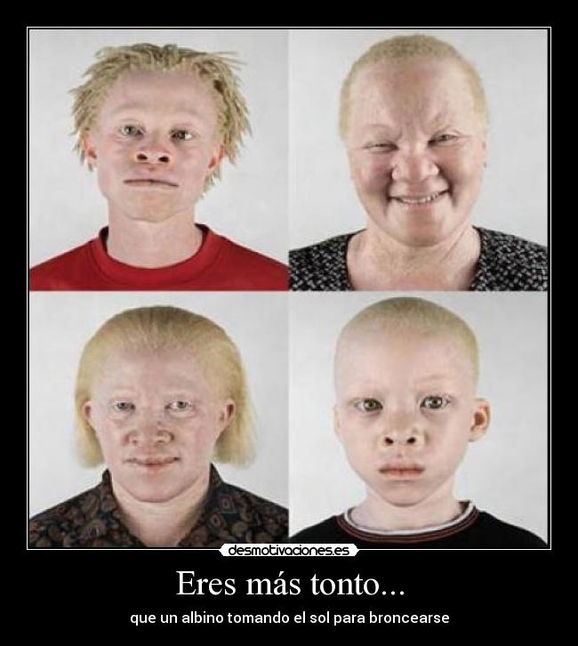 Eres más tonto... -