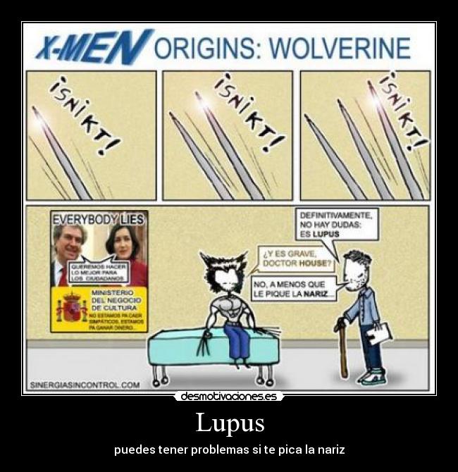 Lupus -