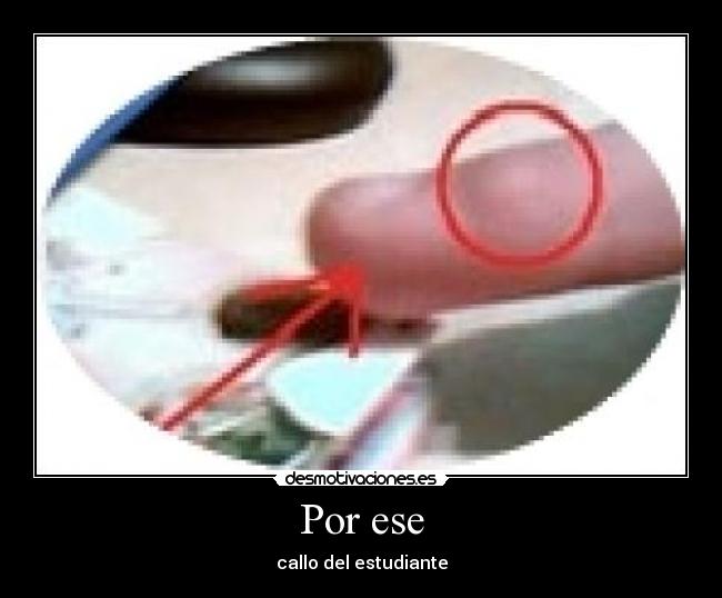 Por ese - callo del estudiante