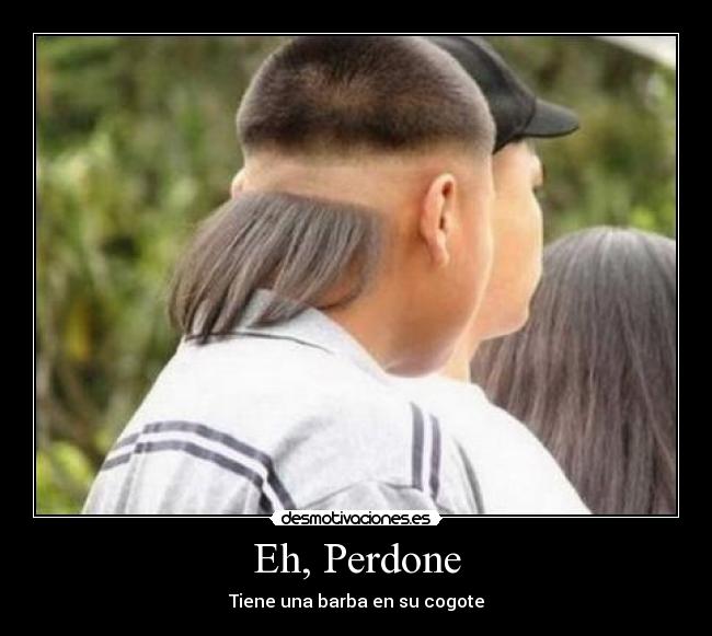 Eh, Perdone - Tiene una barba en su cogote