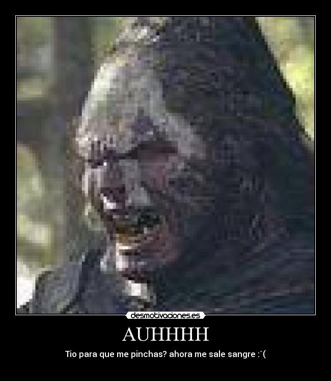 AUHHHH - Tio para que me pinchas? ahora me sale sangre :´(