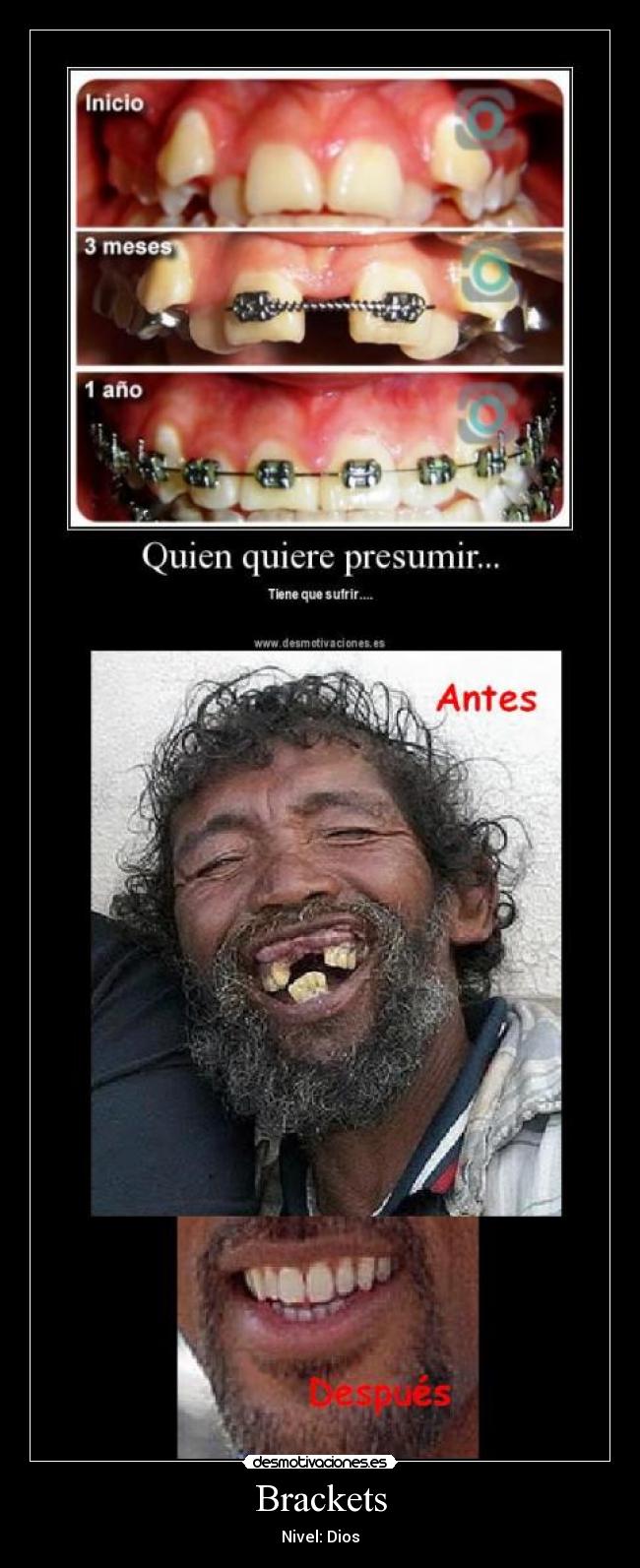Brackets - Nivel: Dios