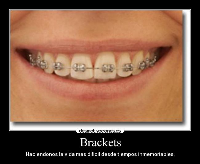 Brackets - Haciendonos la vida mas dificil desde tiempos inmemoriables.