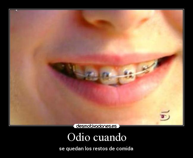 Odio cuando - se quedan los restos de comida 