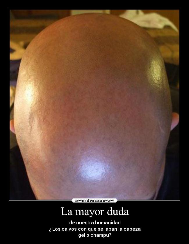 La mayor duda - de nuestra humanidad
¿ Los calvos con que se laban la cabeza
gel o champu?