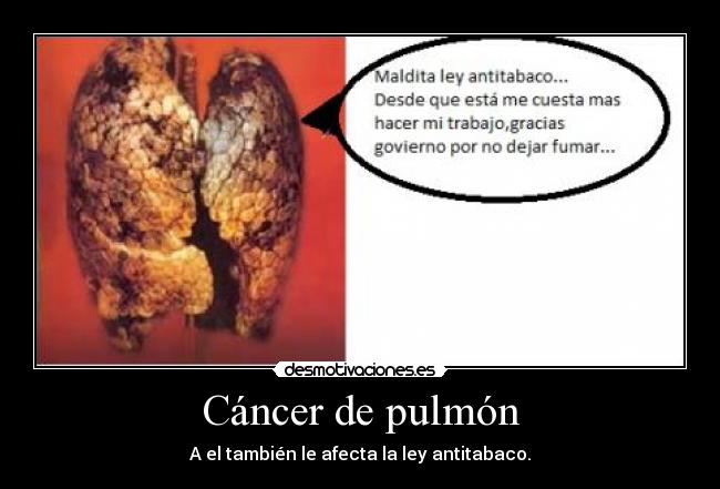Cáncer de pulmón - A el también le afecta la ley antitabaco.