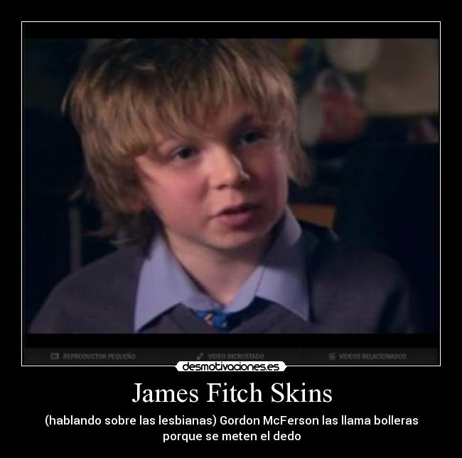 James Fitch Skins -