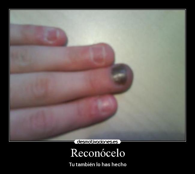 Reconócelo - Tu también lo has hecho