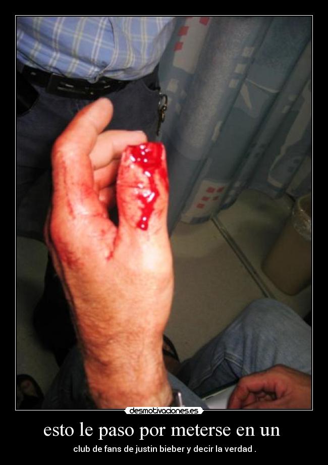 esto le paso por meterse en un -