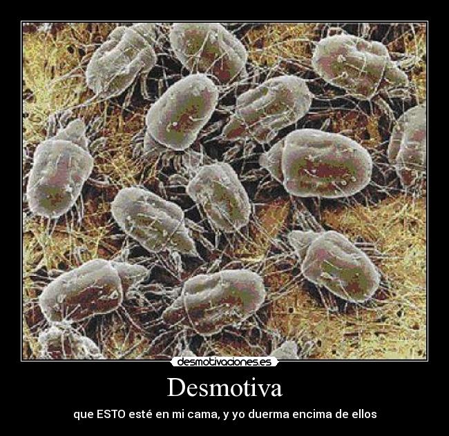 Desmotiva - que ESTO esté en mi cama, y yo duerma encima de ellos