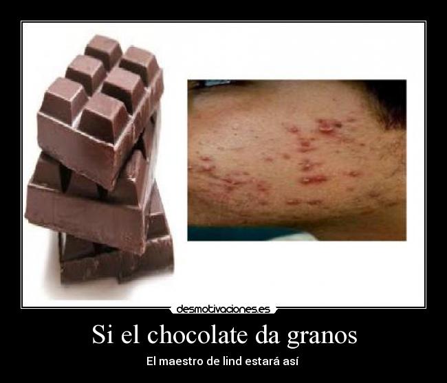 Si el chocolate da granos - El maestro de lind estará así