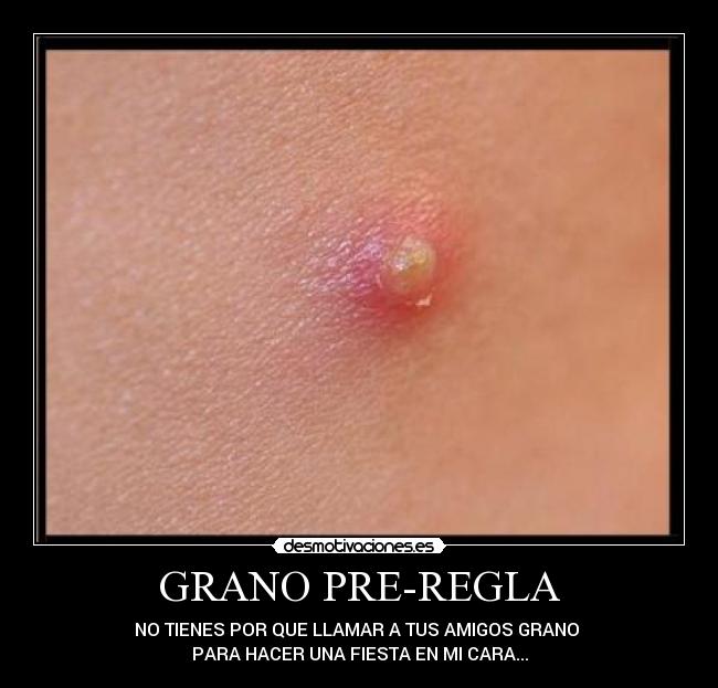 La limpieza de cutis mecánica a los granos