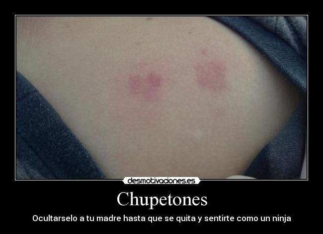 Chupetones - Ocultarselo a tu madre hasta que se quita y sentirte como un ninja