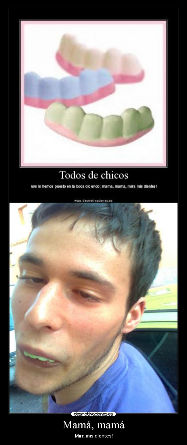 Mamá, mamá - Mira mis dientes!