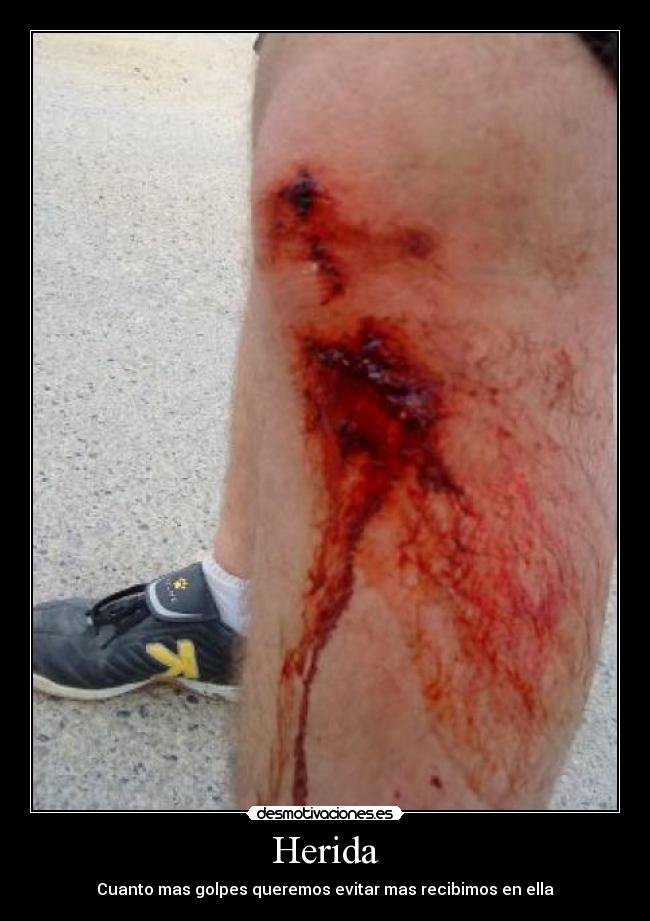 Herida -