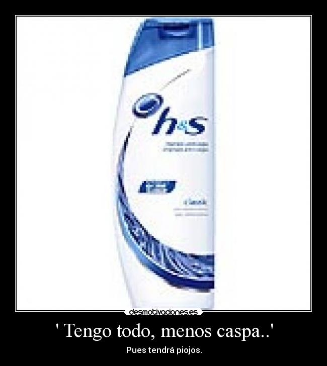 Tengo todo, menos caspa.. -