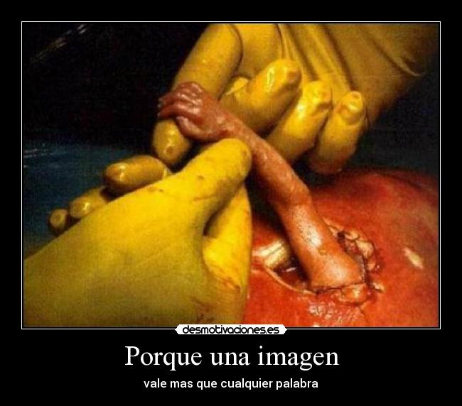 Porque una imagen -