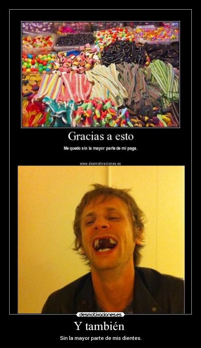 Y también - Sin la mayor parte de mis dientes.
