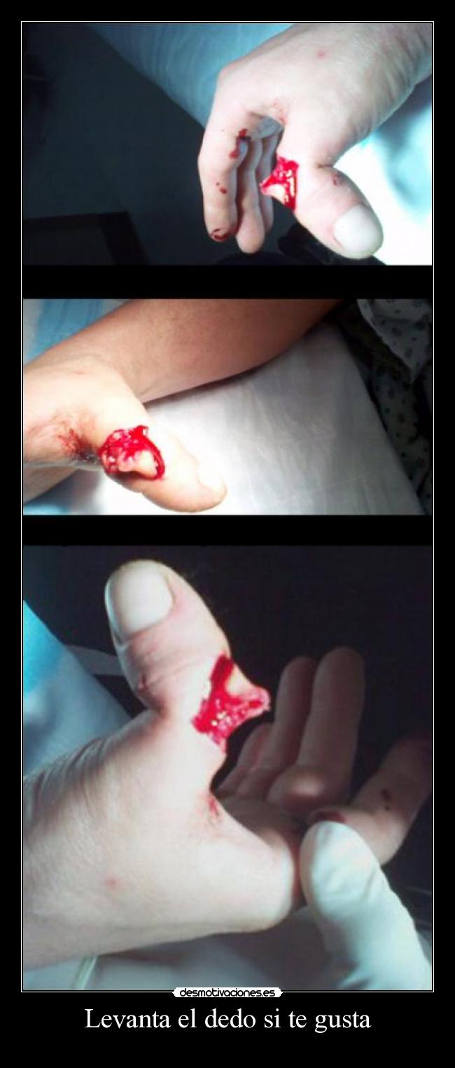 Levanta el dedo si te gusta -