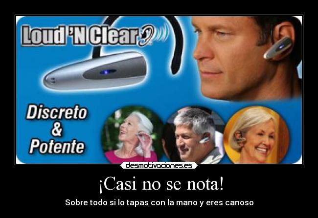 ¡Casi no se nota! - 