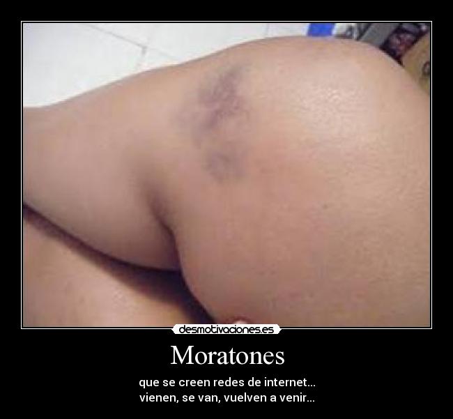 Moratones - que se creen redes de internet...
vienen, se van, vuelven a venir...