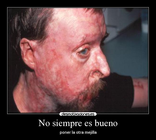 No siempre es bueno - poner la otra mejilla