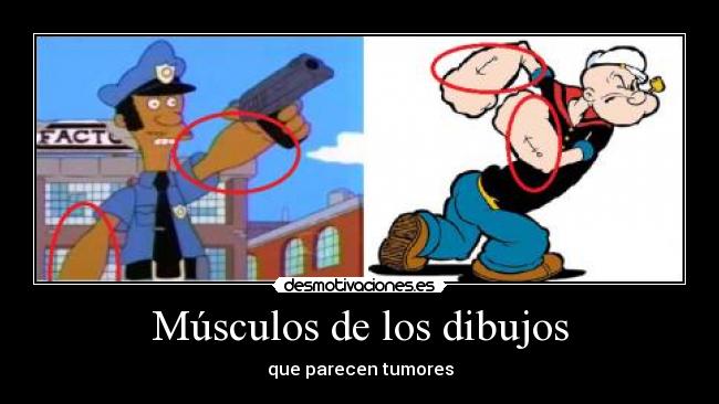 Músculos de los dibujos - que parecen tumores