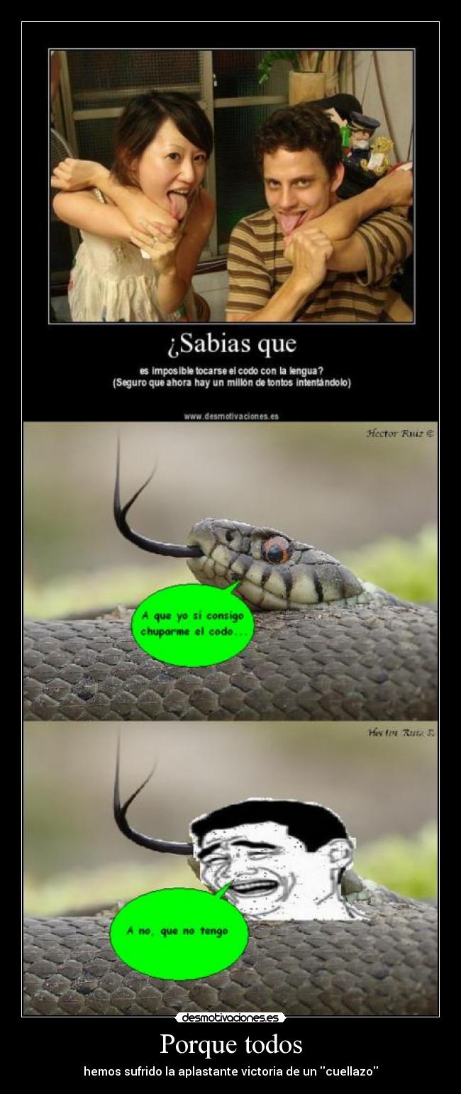 Porque todos - hemos sufrido la aplastante victoria de un cuellazo