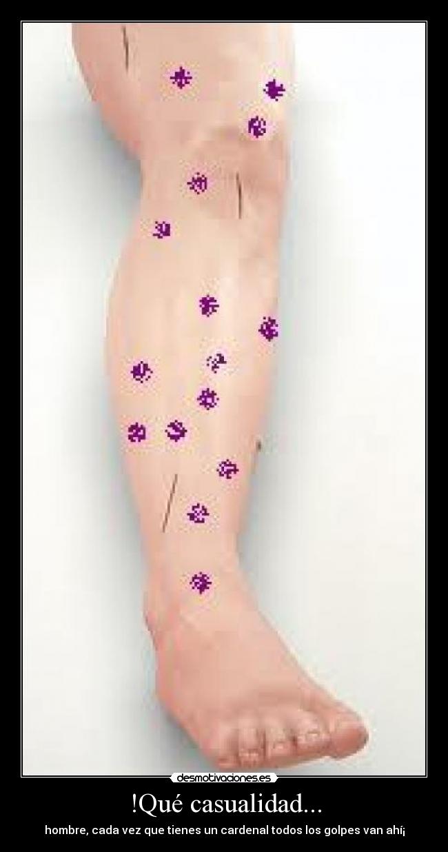 !Qué casualidad... - hombre, cada vez que tienes un cardenal todos los golpes van ahí¡