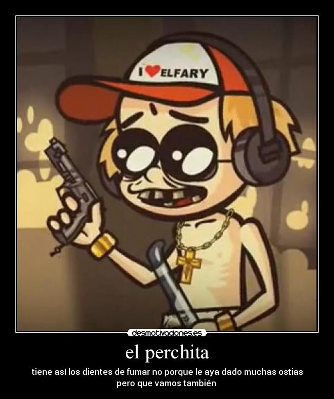 el perchita - tiene así los dientes de fumar no porque le aya dado muchas ostias
pero que vamos también