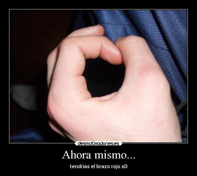 Ahora mismo... - tendrias el brazo rojo xD