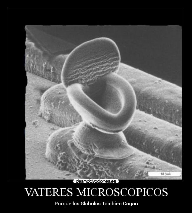 VATERES MICROSCOPICOS - Porque los Globulos Tambien Cagan