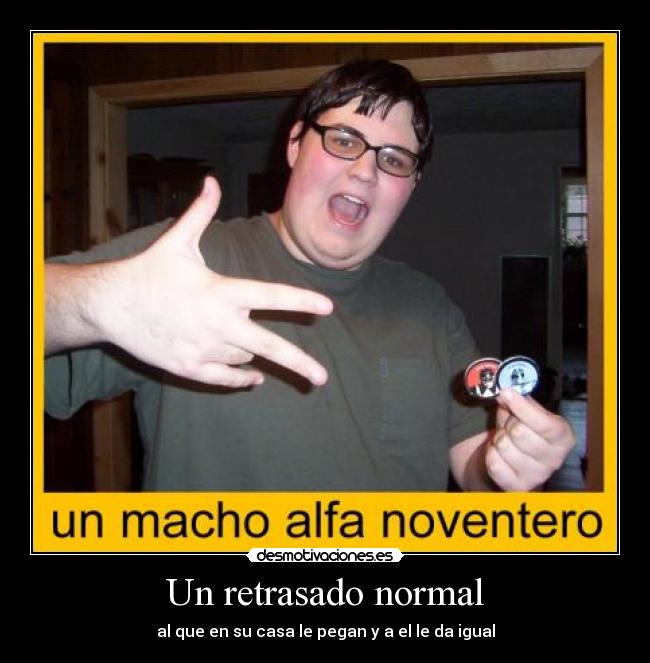 Un retrasado normal -