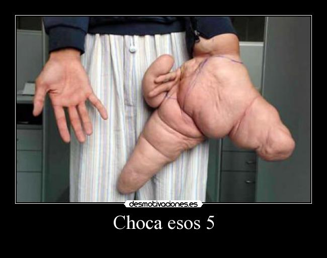 Choca esos 5 - 