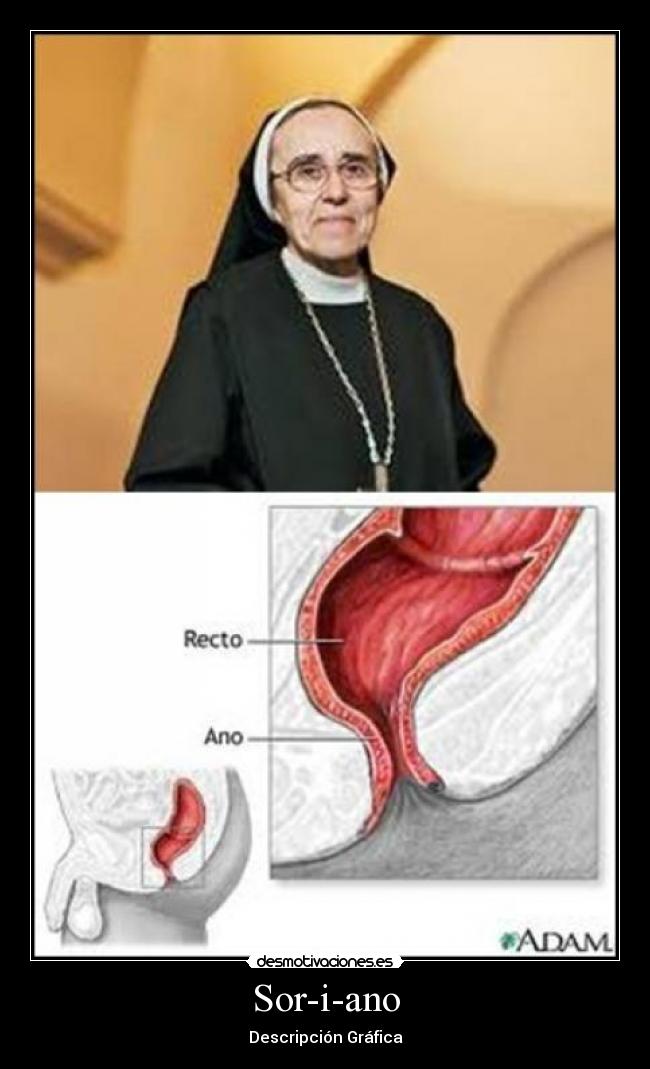 Sor-i-ano - Descripción Gráfica