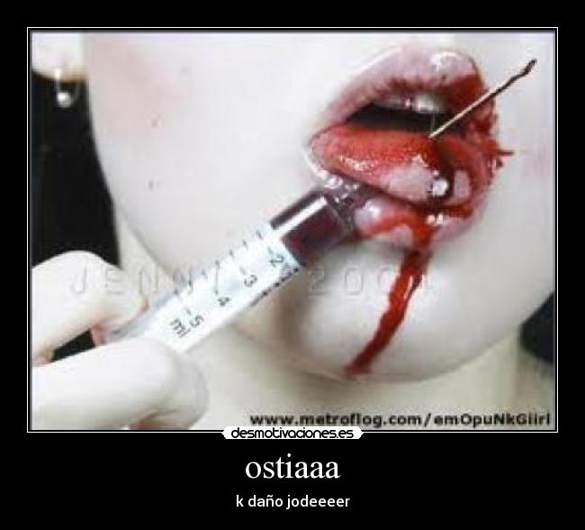 ostiaaa - 