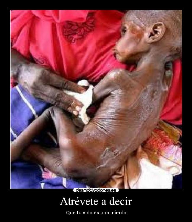 Atrévete a decir - Que tu vida es una mierda