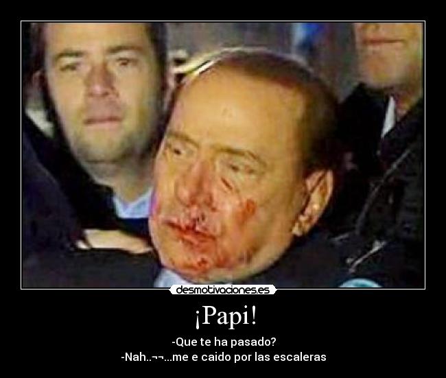 ¡Papi! - -Que te ha pasado?
-Nah..¬¬...me e caido por las escaleras
