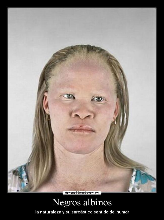 Negros albinos - la naturaleza y su sarcástico sentido del humor