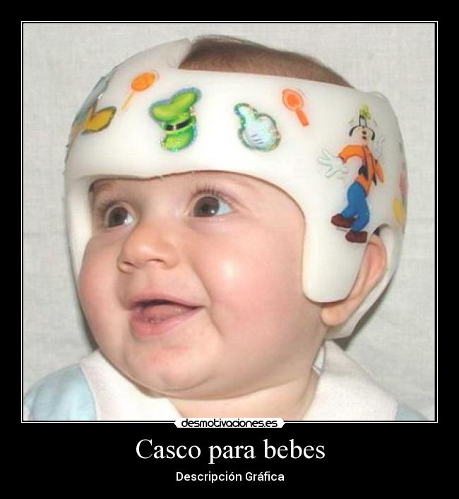 Casco para bebes - Descripción Gráfica