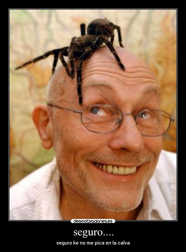 seguro.... - seguro ke no me pica en la calva