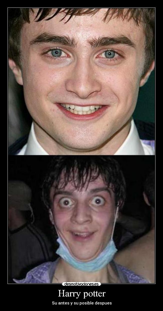 Harry potter - Su antes y su posible despues