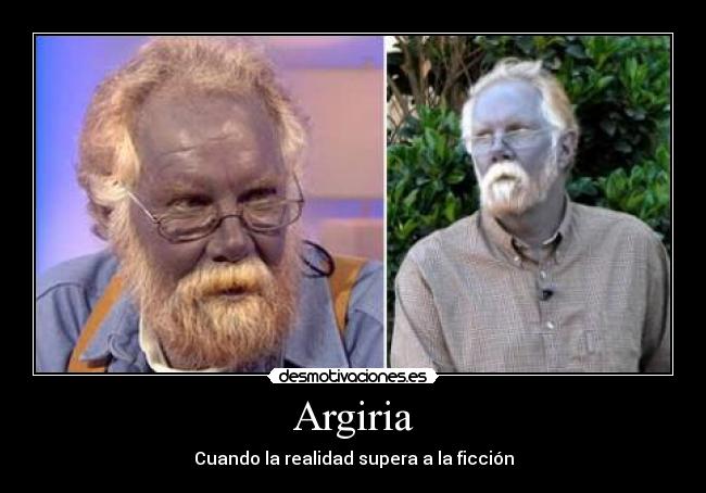Argiria - Cuando la realidad supera a la ficción